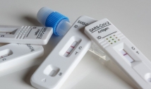 Anvisa aprova primeiro autoteste de Covid-19 que usa a saliva