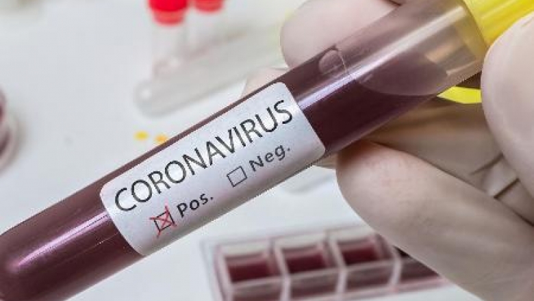 Casos de coronavírus sobem para 110 e mortes para 13 na PB