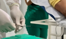 Patos realiza mais um mutirão de cirurgias dermatológicas no Centro de Saúde Frei Damião